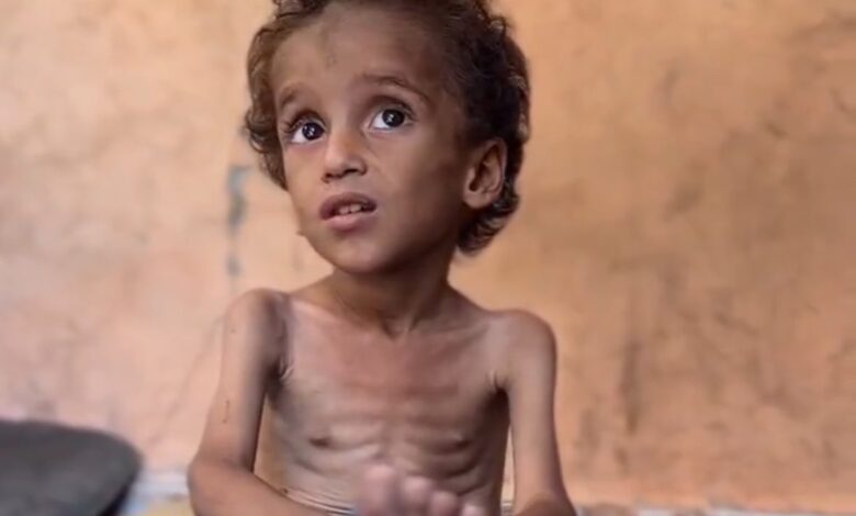 The image has been taken from a post on X by @mhdksafa, who wrote, "Gaza doesn’t have enough food for the children. It’s not famine. It’s forced starvation. Forced starvation is an act of genocide."